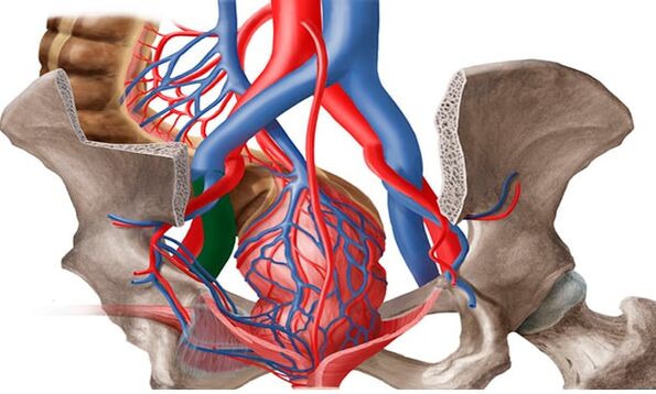 varicose veins in the small pelvis