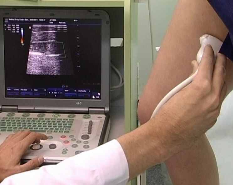 ultrasound diagnosis of varicose veins in the pelvis