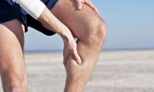 varicose veins on the legs, in men